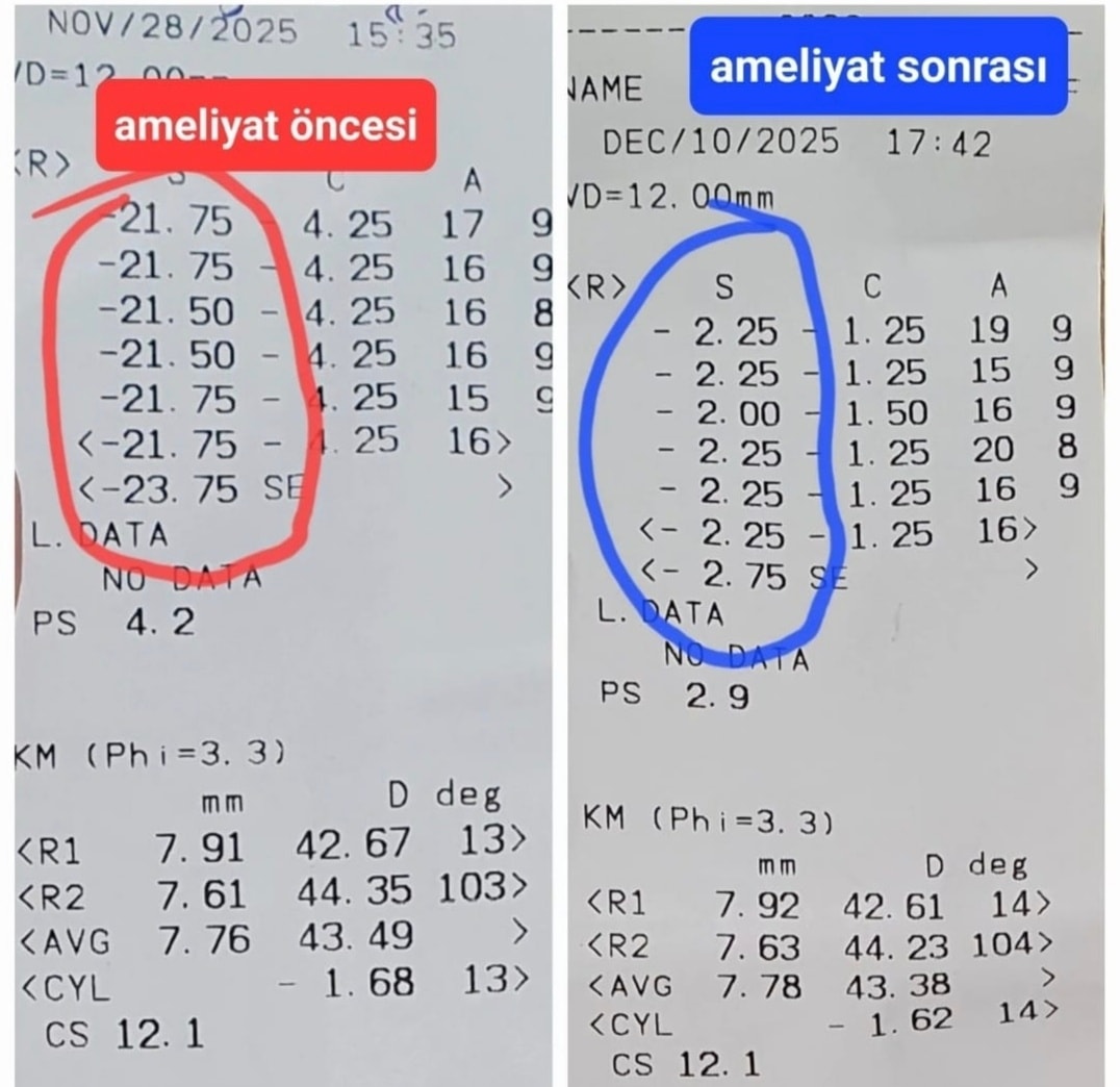 Sandıklı Devlet Hastanesinde Katarakt Ameliyatı Başarısı